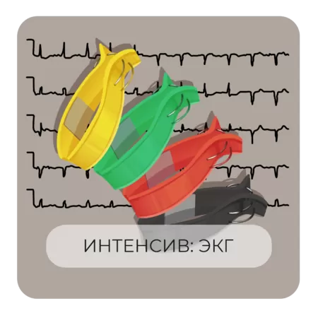 Интенсив ЭКГ